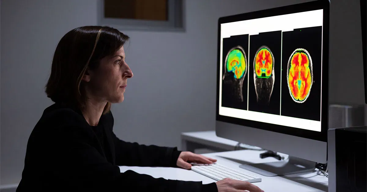 AI Tool Predicts Alzheimer's Disease With 92.87% Accuracy Using MRI ...